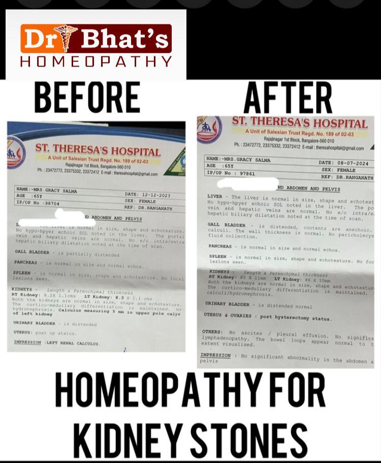 Homeopathic medicines and natural remedies at the Bengaluru clinic